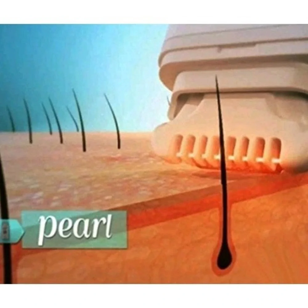 Pearl  - Hair removal system - cordless - white‎ pearlescent/chrome accents